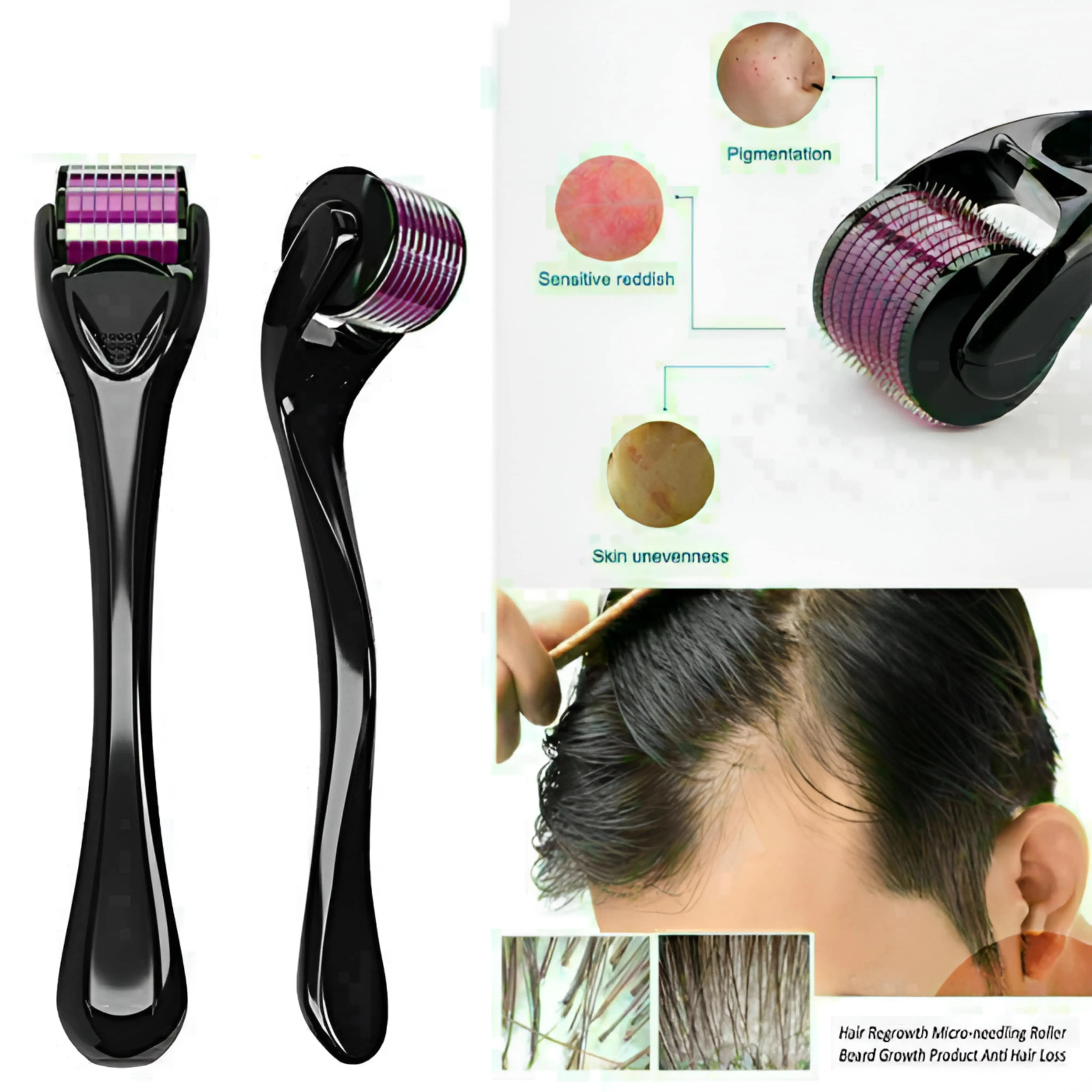 Titanium Micro Needle Skin Derma Roller - Image 5