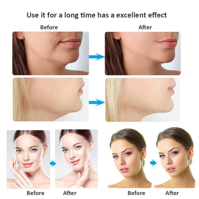 V Shape Face Slimming LED Device - Image 8