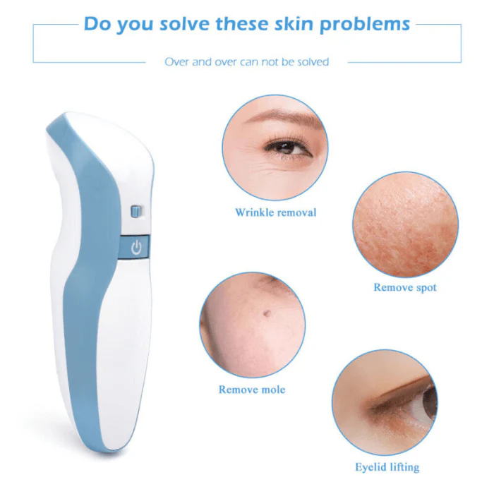 Professional Fibroblast Plasma Pen Skin Tag Removal - Image 3