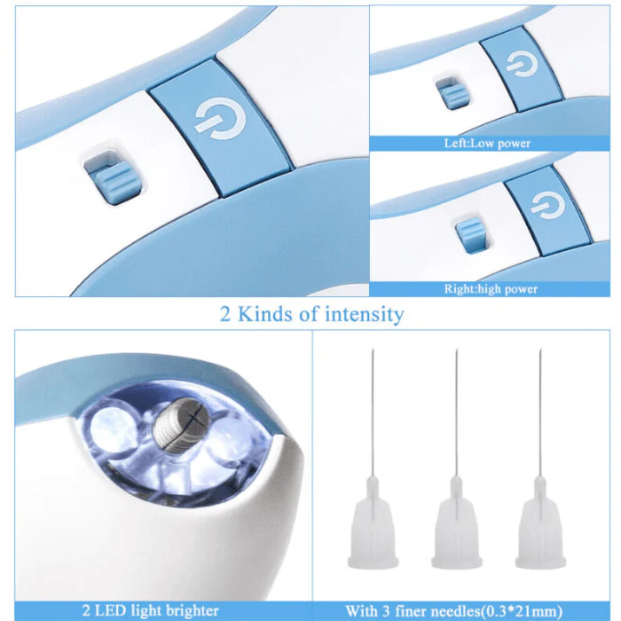 Professional Fibroblast Plasma Pen Skin Tag Removal - Image 6