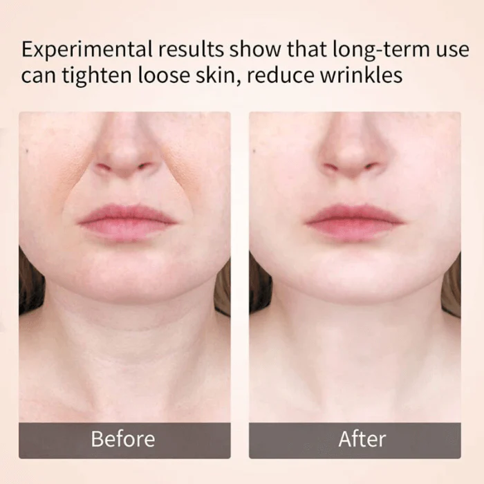 Anti-Aging Face lift and Neck Skin Tightening Massager - Image 6